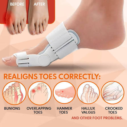 Flexible Day & Night Foot Support - Image 3